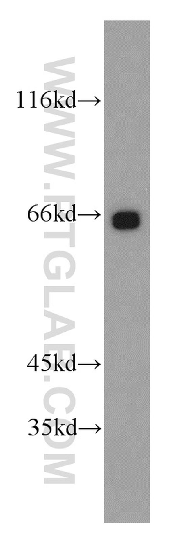 BBS6 Antibody in Western Blot (WB)