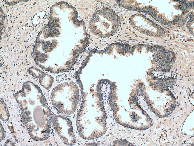 SLC25A32 Antibody in Immunohistochemistry (Paraffin) (IHC (P))