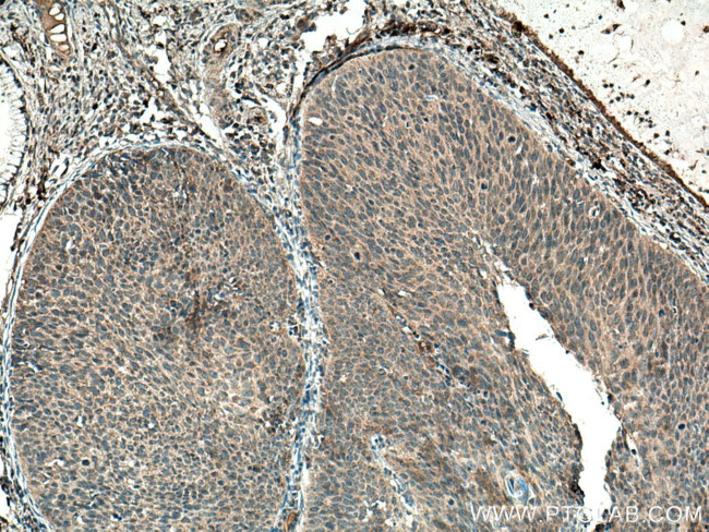 IL-17 Antibody in Immunohistochemistry (Paraffin) (IHC (P))