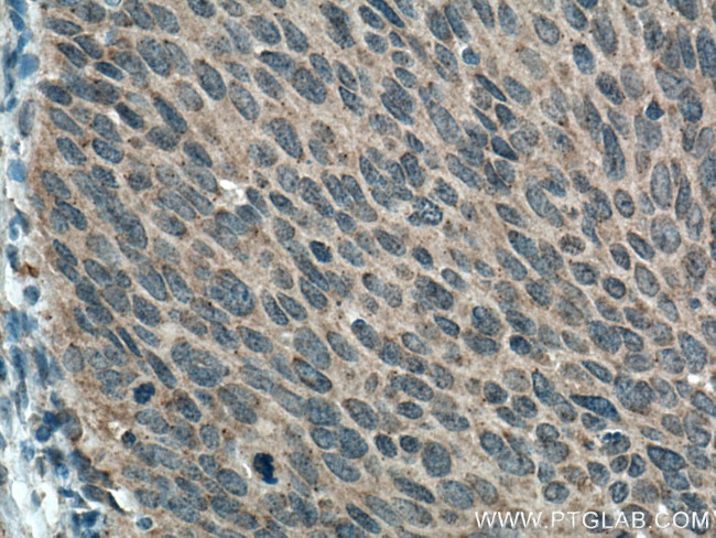 IL-17 Antibody in Immunohistochemistry (Paraffin) (IHC (P))