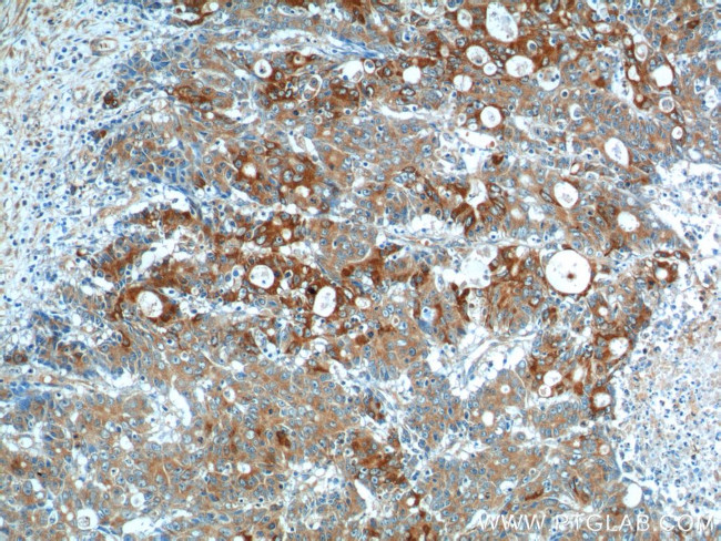 IL-17 Antibody in Immunohistochemistry (Paraffin) (IHC (P))