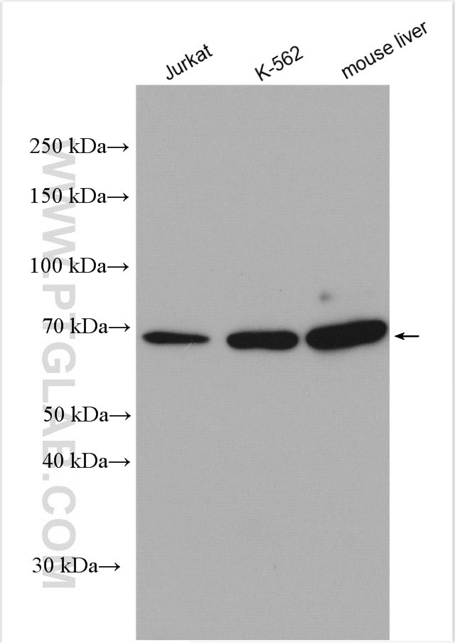 IFNAR1 Antibody in Western Blot (WB)