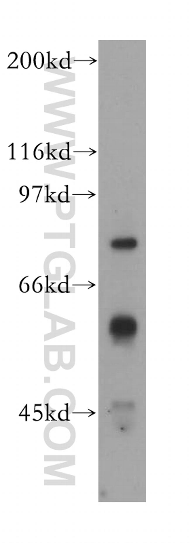 IFNAR1 Antibody in Western Blot (WB)