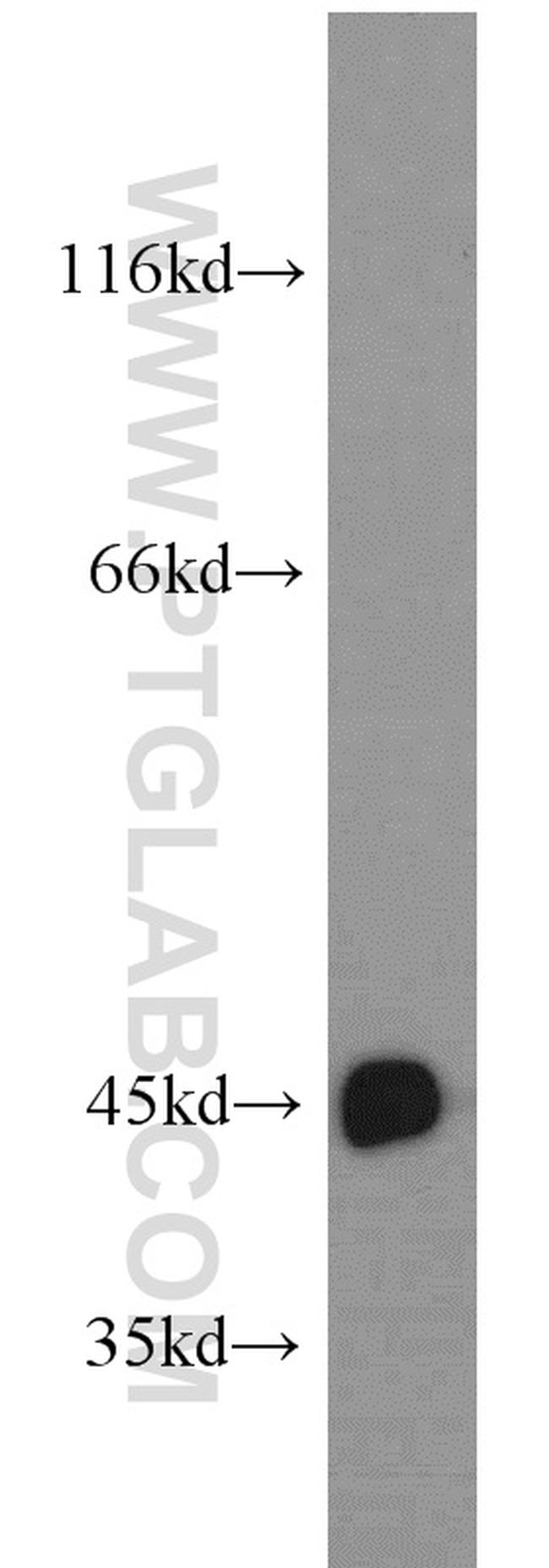 CTNS Antibody in Western Blot (WB)