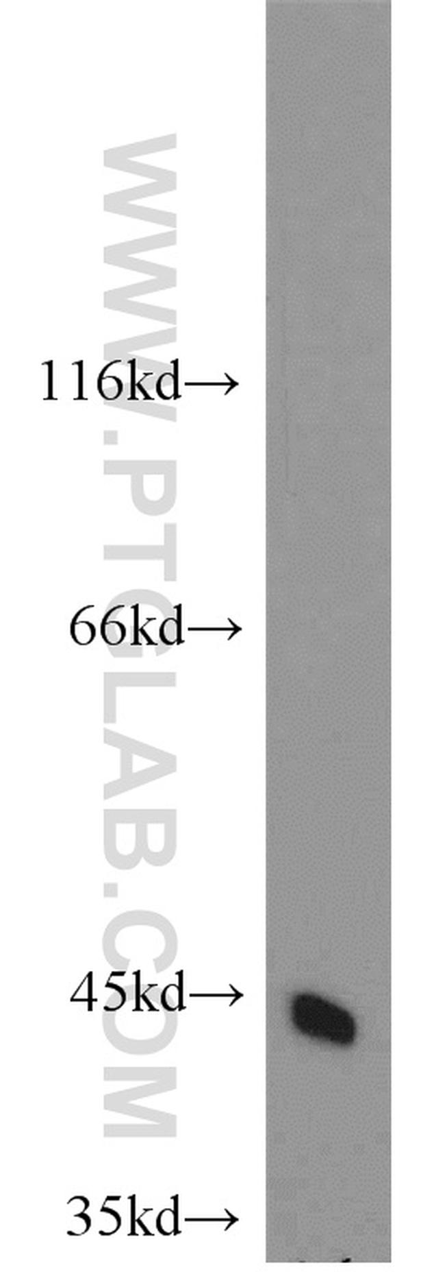 CTNS Antibody in Western Blot (WB)