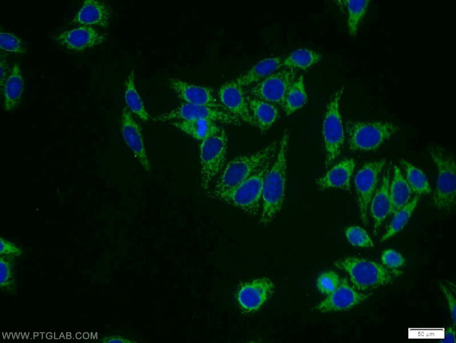 FREM1 Antibody in Immunocytochemistry (ICC/IF)