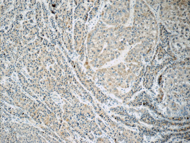 FREM1 Antibody in Immunohistochemistry (Paraffin) (IHC (P))