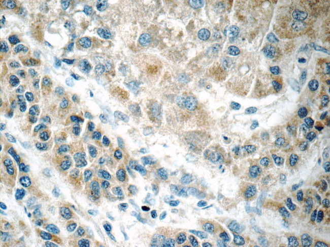 FREM1 Antibody in Immunohistochemistry (Paraffin) (IHC (P))