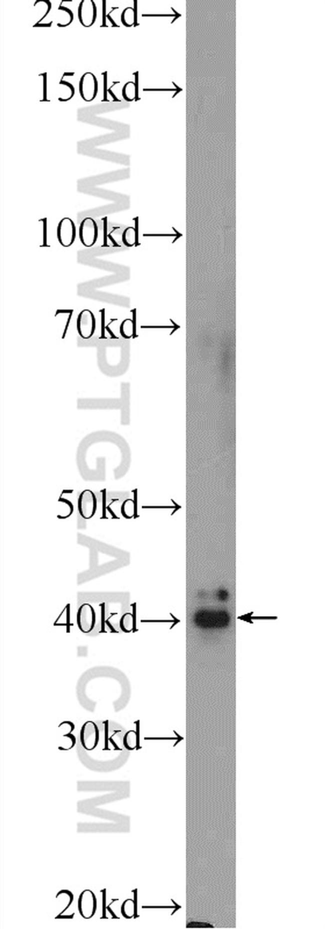 FREM1 Antibody in Western Blot (WB)