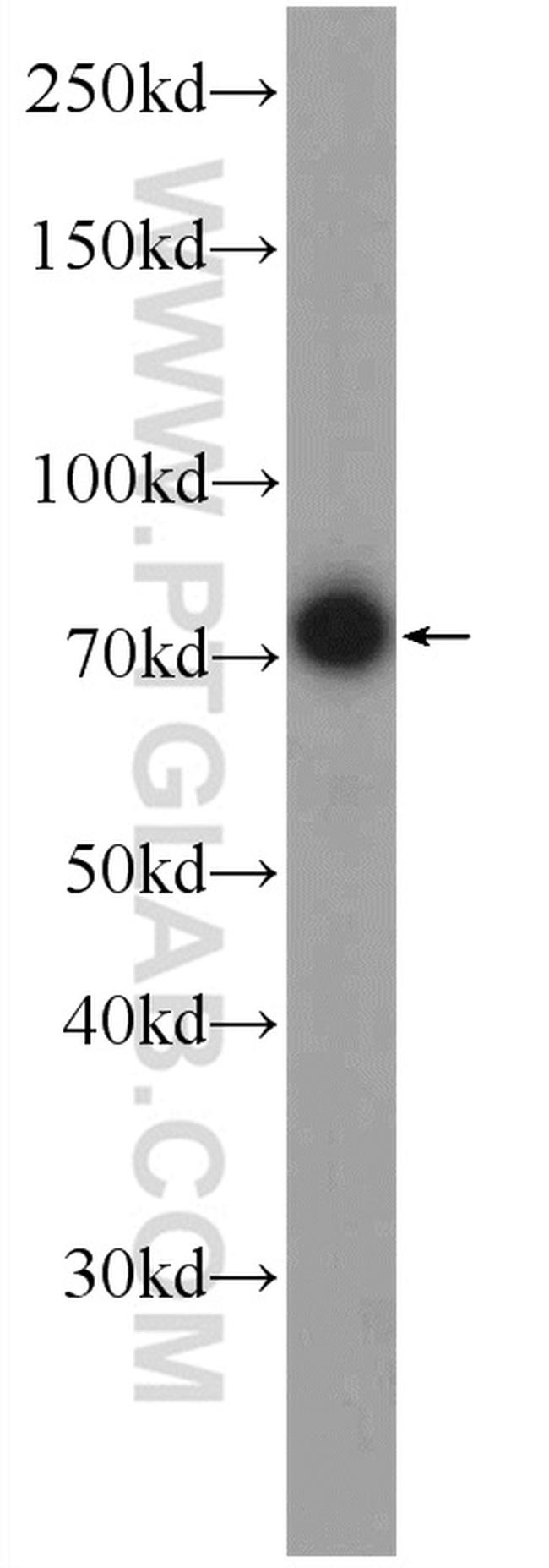 FREM1 Antibody in Western Blot (WB)