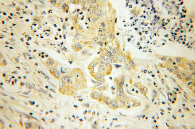 TRX2 Antibody in Immunohistochemistry (Paraffin) (IHC (P))