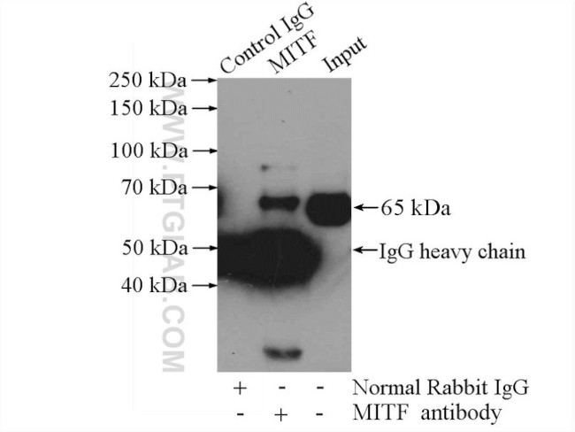 MITF Antibody in Immunoprecipitation (IP)