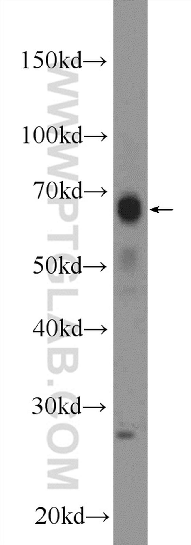 MITF Antibody in Western Blot (WB)