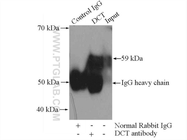 DCT Antibody in Immunoprecipitation (IP)