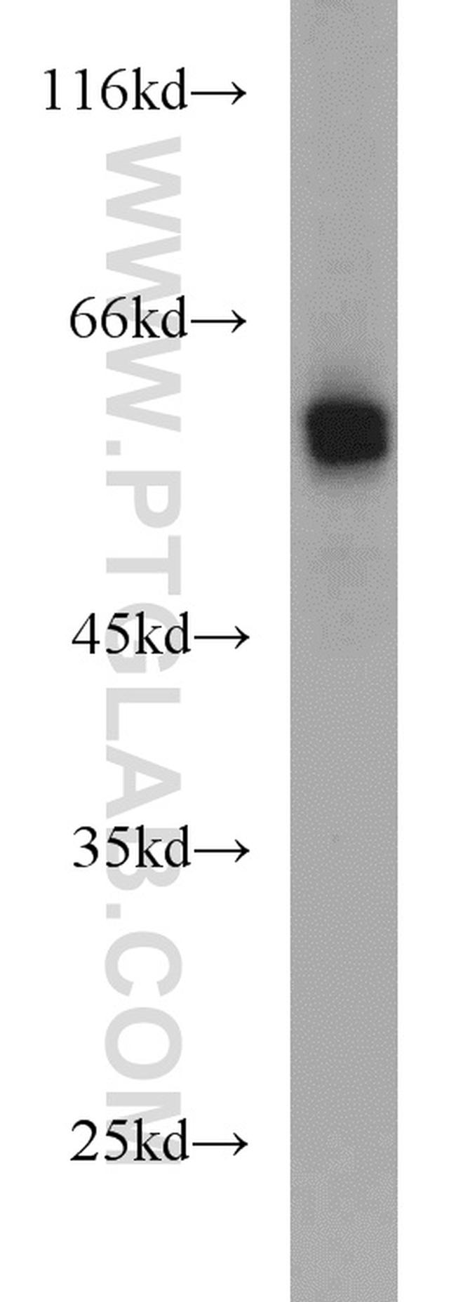 DCT Antibody in Western Blot (WB)