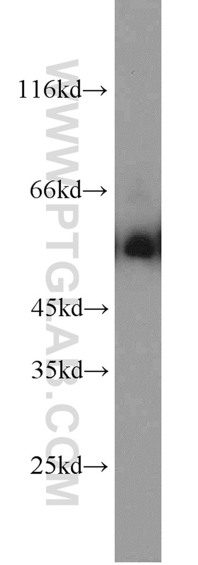 DCT Antibody in Western Blot (WB)