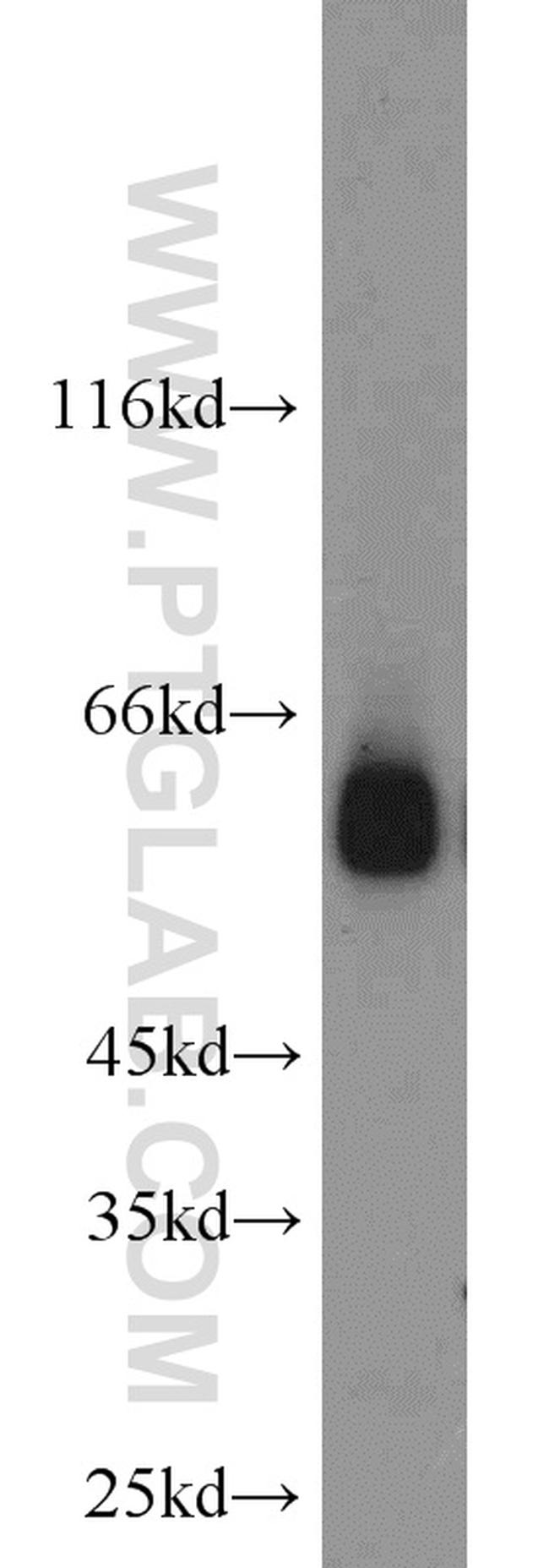 DCT Antibody in Western Blot (WB)