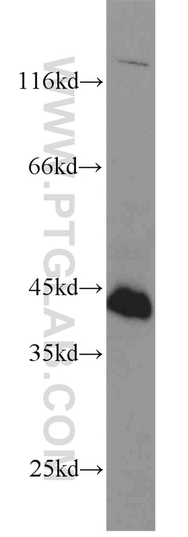 FAS/CD95 Antibody in Western Blot (WB)