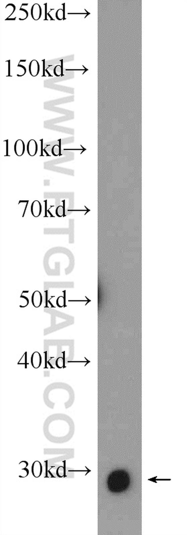 SNAI1 Antibody in Western Blot (WB)