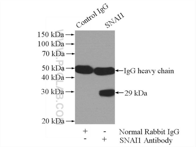 SNAI1 Antibody in Immunoprecipitation (IP)