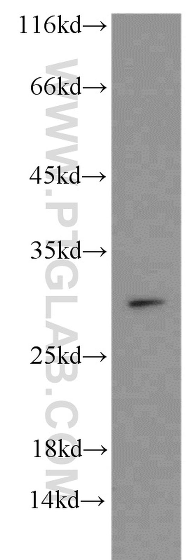 SNAI1 Antibody in Western Blot (WB)