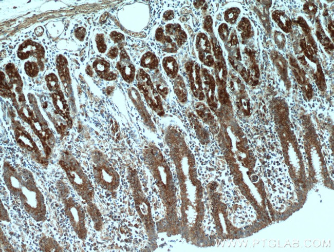 DNAJC10 Antibody in Immunohistochemistry (Paraffin) (IHC (P))