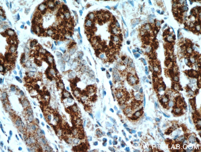 DNAJC10 Antibody in Immunohistochemistry (Paraffin) (IHC (P))