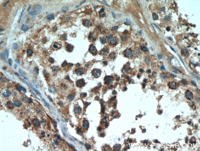 DNAJC10 Antibody in Immunohistochemistry (Paraffin) (IHC (P))