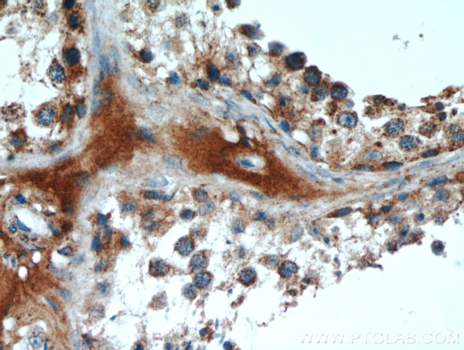 DNAJC10 Antibody in Immunohistochemistry (Paraffin) (IHC (P))