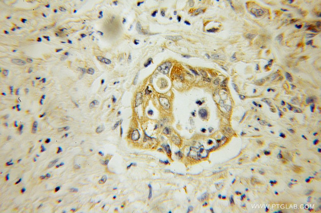 DNAJC10 Antibody in Immunohistochemistry (Paraffin) (IHC (P))