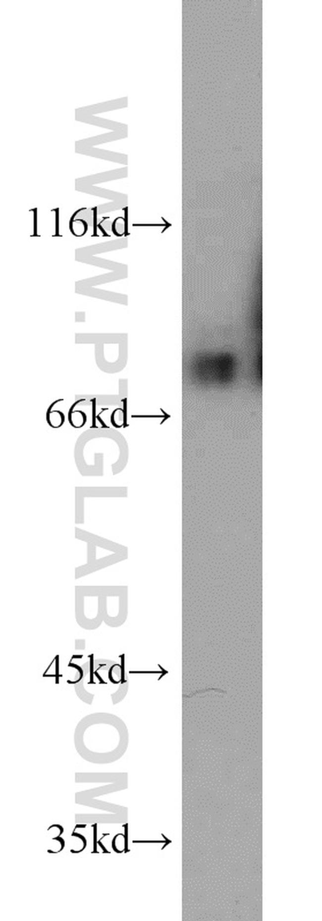 DNAJC10 Antibody in Western Blot (WB)