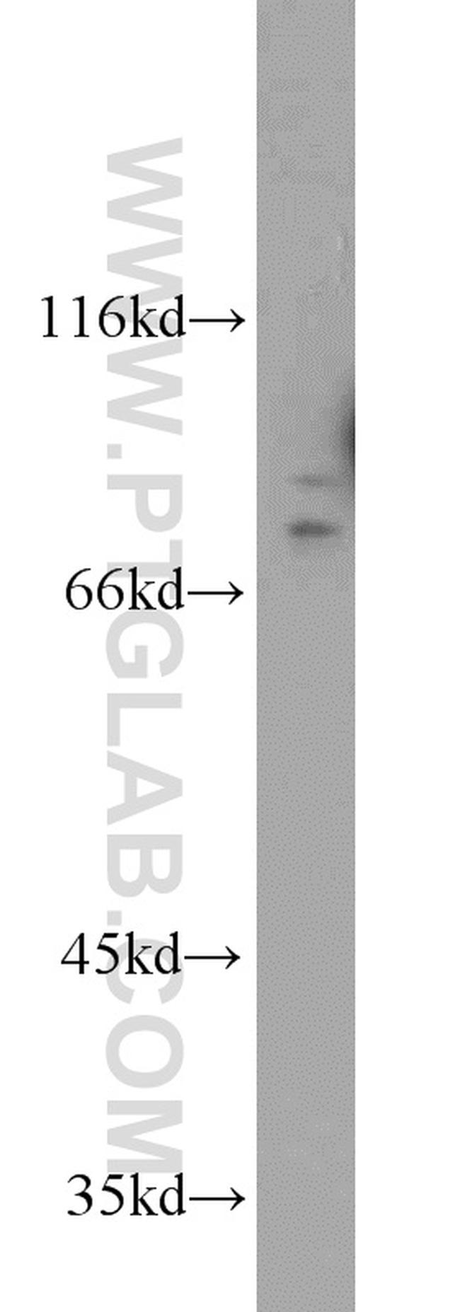 DNAJC10 Antibody in Western Blot (WB)