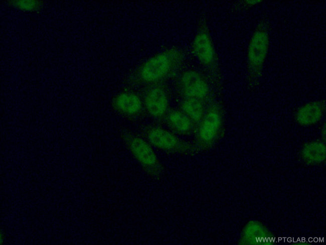 TSEN2 Antibody in Immunocytochemistry (ICC/IF)