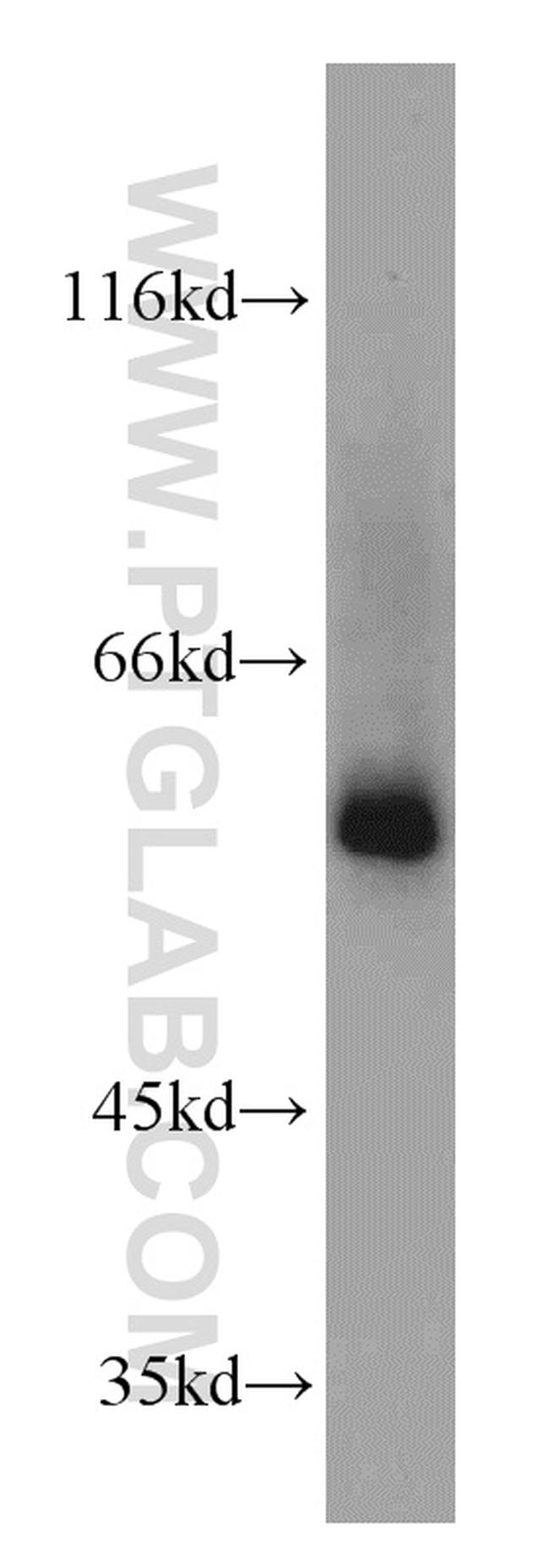 TSEN2 Antibody in Western Blot (WB)