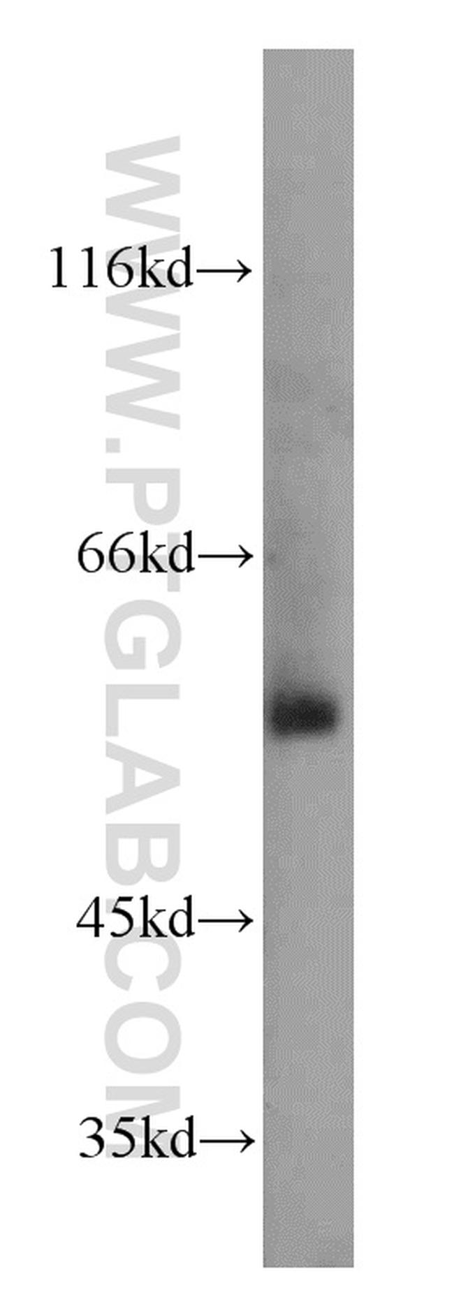 TSEN2 Antibody in Western Blot (WB)