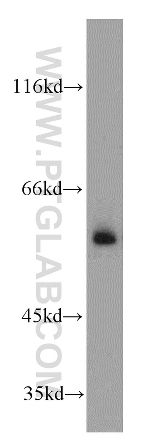 TSEN2 Antibody in Western Blot (WB)