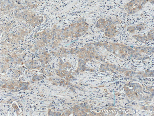 KIF2A Antibody in Immunohistochemistry (Paraffin) (IHC (P))