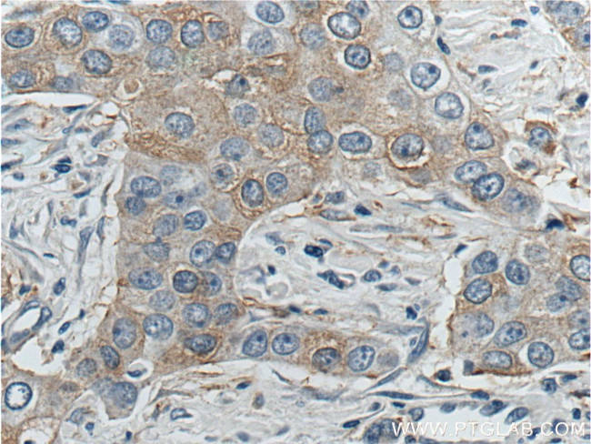 KIF2A Antibody in Immunohistochemistry (Paraffin) (IHC (P))