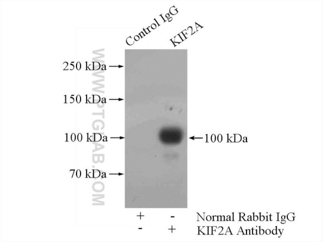 KIF2A Antibody in Immunoprecipitation (IP)