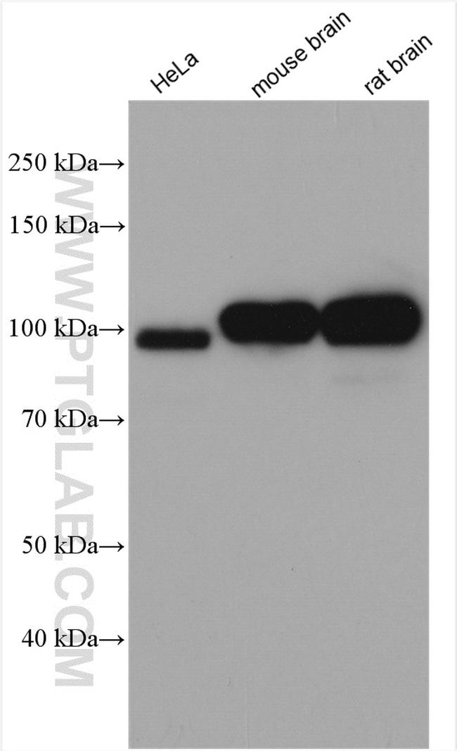 KIF2A Antibody in Western Blot (WB)