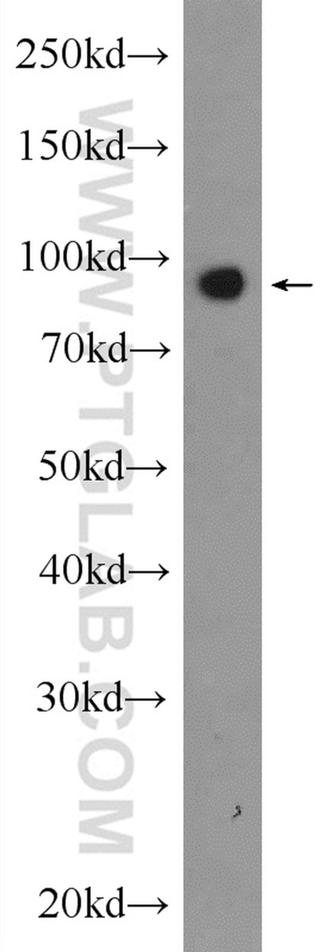 KIF2A Antibody in Western Blot (WB)