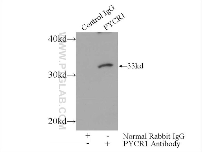 PYCR1 Antibody in Immunoprecipitation (IP)