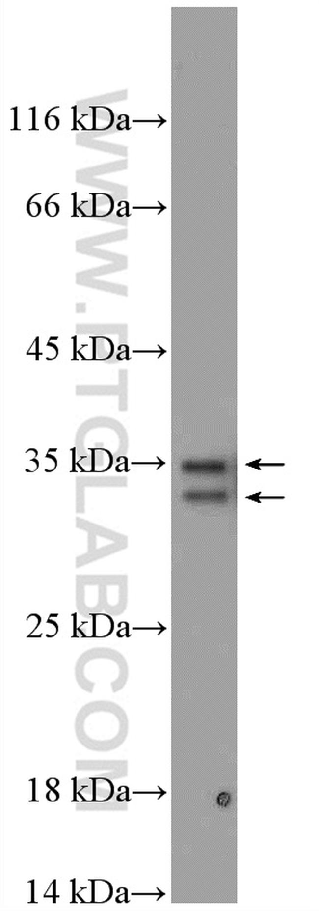 PYCR1 Antibody in Western Blot (WB)