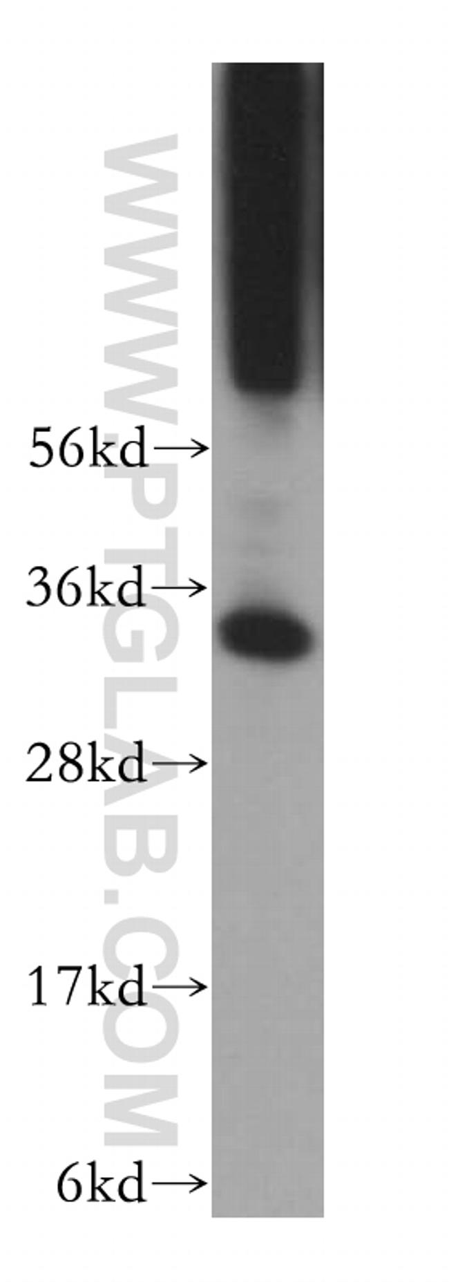 PYCR1 Antibody in Western Blot (WB)