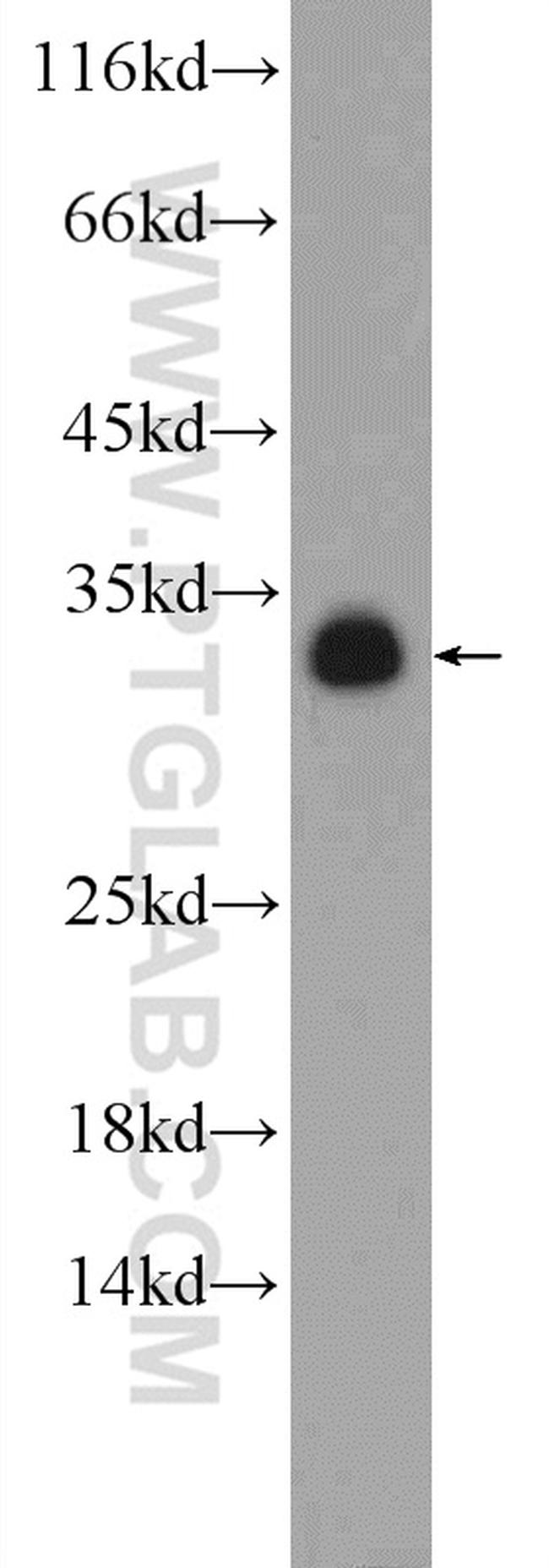 PYCR1 Antibody in Western Blot (WB)