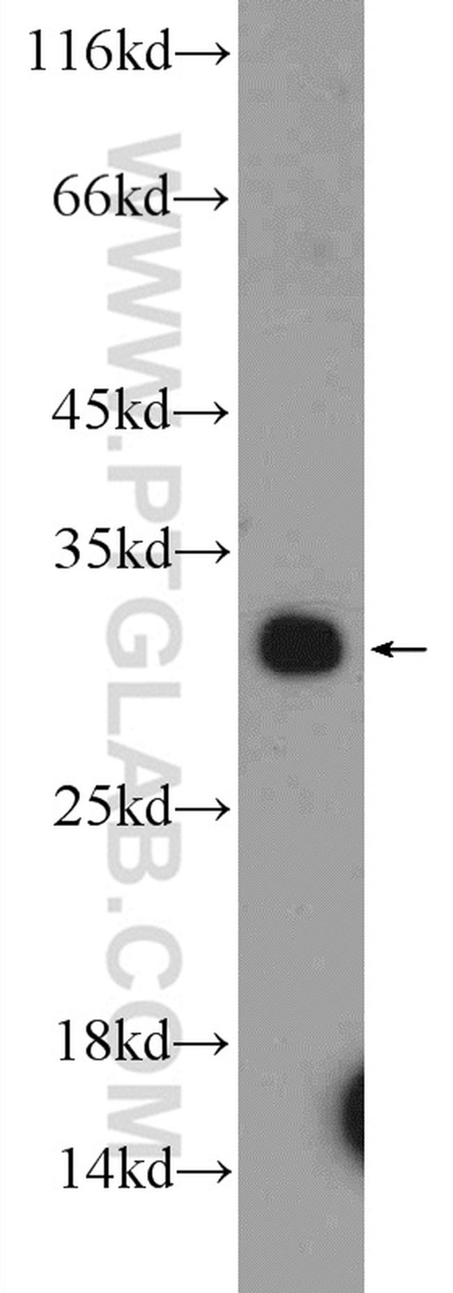 PYCR1 Antibody in Western Blot (WB)