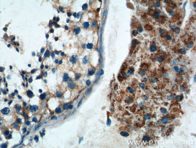 TNF beta Antibody in Immunohistochemistry (Paraffin) (IHC (P))