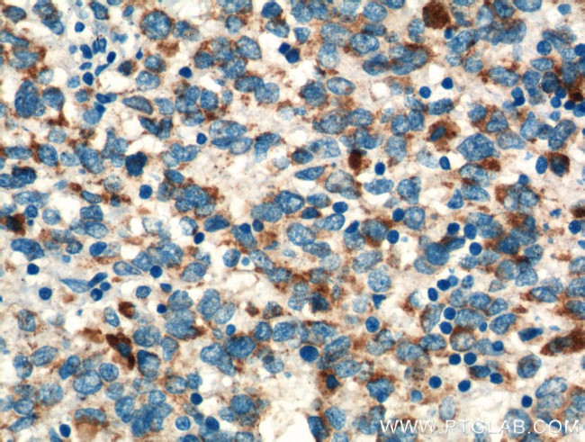 TNF beta Antibody in Immunohistochemistry (Paraffin) (IHC (P))