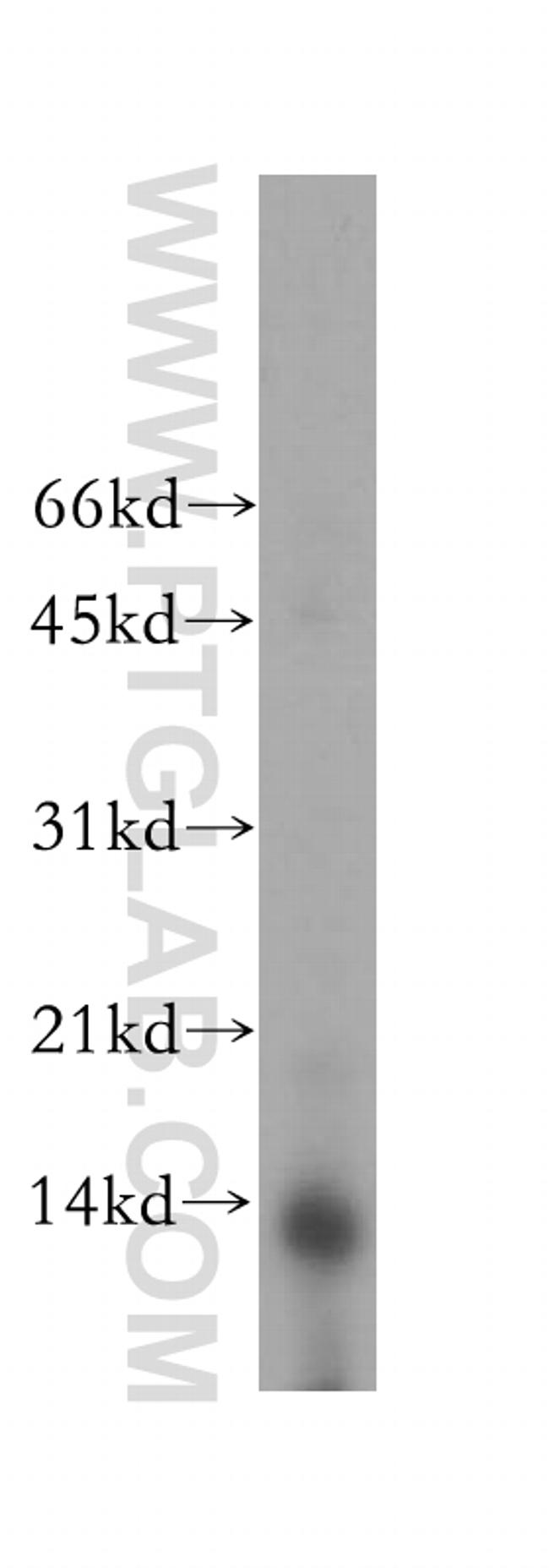 PHPT1 Antibody in Western Blot (WB)