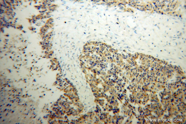 MTHFS Antibody in Immunohistochemistry (Paraffin) (IHC (P))